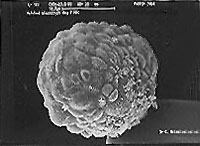 blastocyst.JPG (13967 bytes)