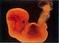 embryo.JPG (13098 bytes)
