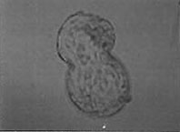 infertility.JPG (5966 bytes)