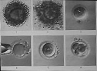 sperm-slide.JPG (11004 bytes)